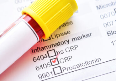 Why Seronegative Rheumatic Diseases Are Difficult to Diagnose
