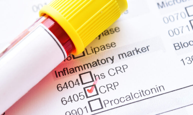 Vial of blood resting on top of paperwork regarding inflammatory markers.