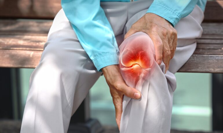 Man holding knee in pain because of osteoarthritis flare-up.
